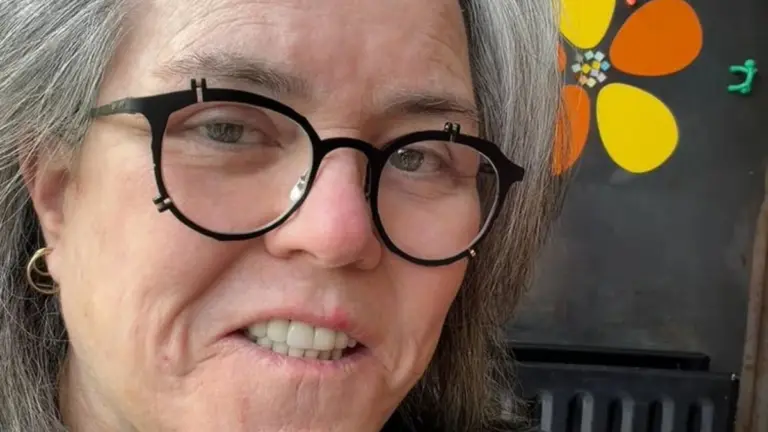 Rosie O’Donnell Reveals Dramatic Facelift Transformation With Before-and-After Photos: “Best Possible Outcome”
