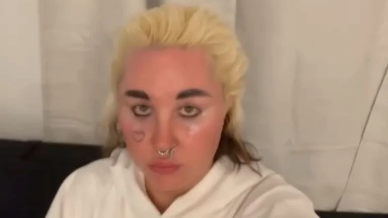 ‘Hairspray’ Star Amanda Bynes (40) Shows Off Her Ozempic Transformation While Spotted Out With Her Boyfriend